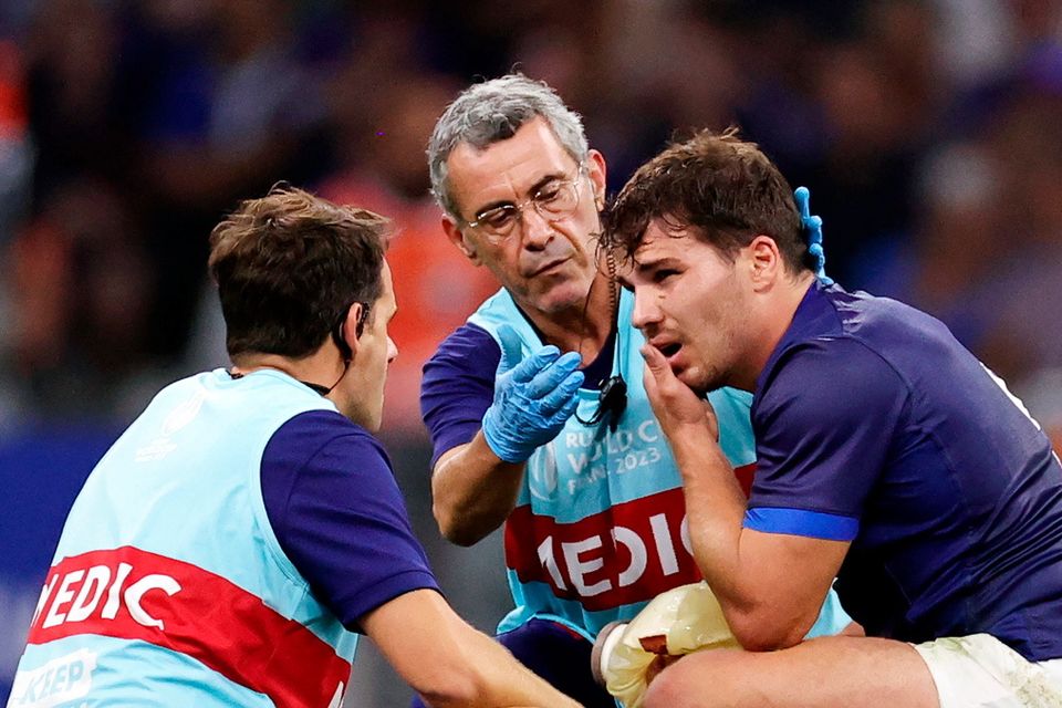 France captain Dupont undergoes facial surgery 7