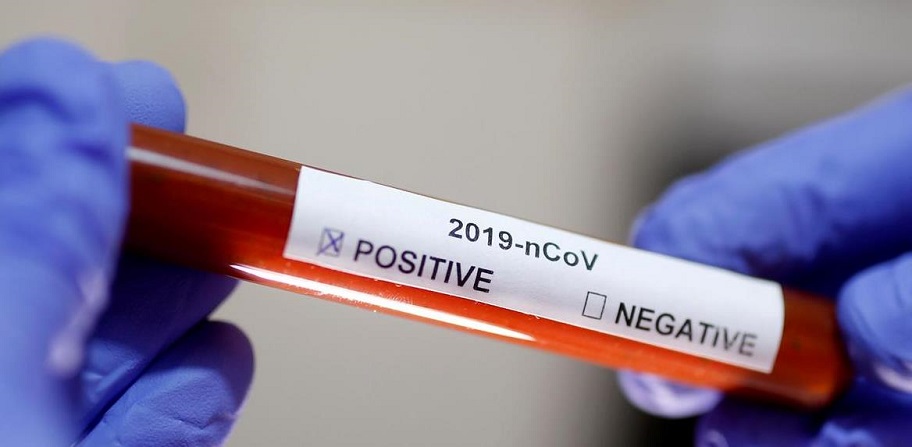 От ПСЖ обявиха за заразен играч с коронавирус