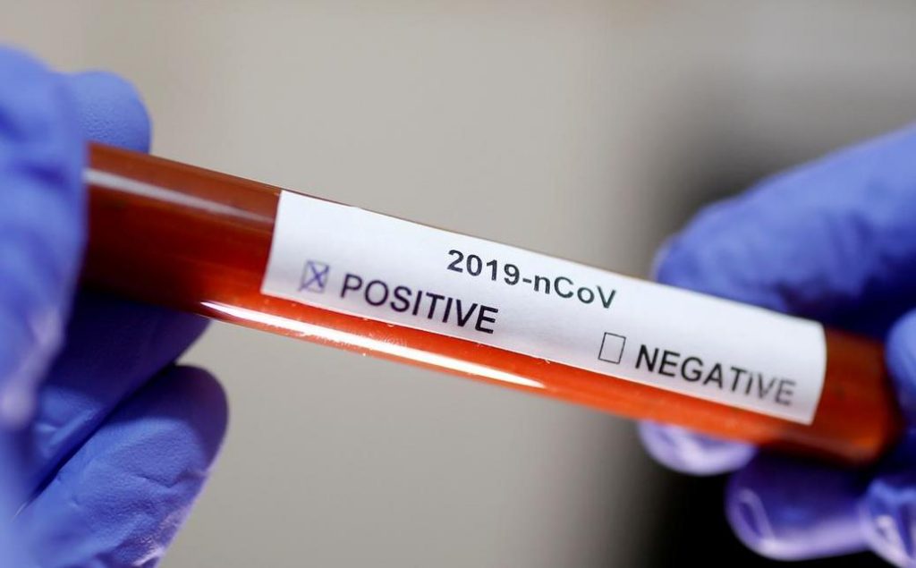 Бум на заразени с COVID-19 във френски елитен отбор