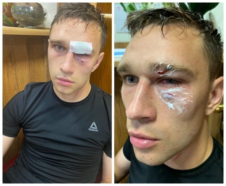 Бивш капитан на Русия нокаутира рефер